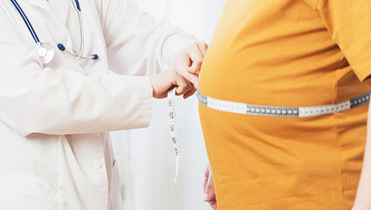 Un plan national de lutte contre l’obésité