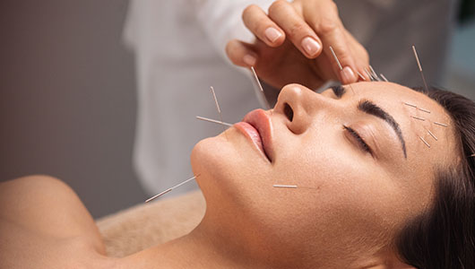 remboursement acuponcture